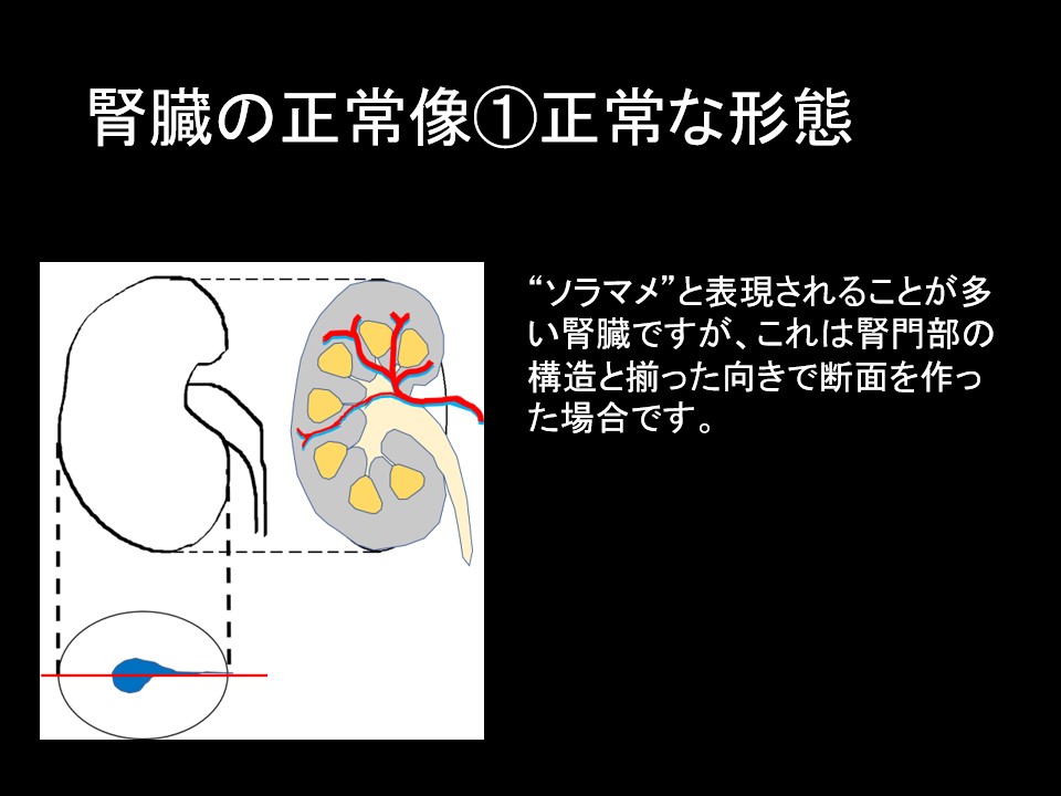 ハイチ 災害